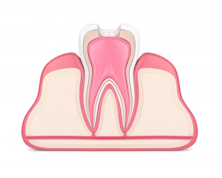 Removing Decay With A Root Canal Dallas, TX